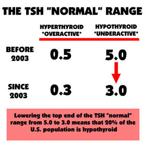 hypothyroidism diagnosis