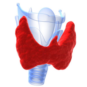 Picture Of Hypothyroidism