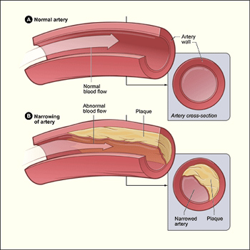 underactive thyroid symptoms